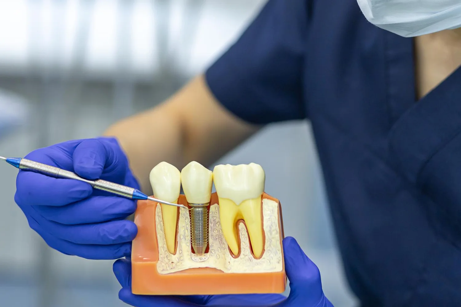 Suggestives Bild für Implantologie